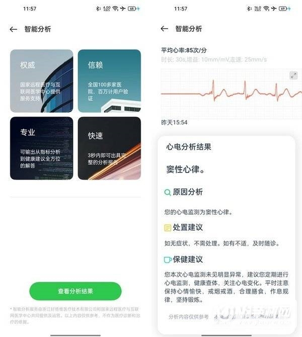 OPPOWatch2ECG版全面评测-性能详情