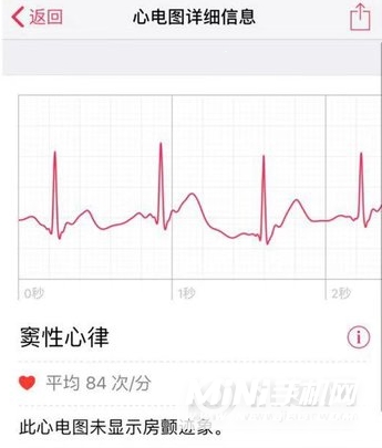 AppleWatch7怎么查看心电图数据-心电图记录在哪看